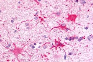 GPR81 Antibody in Immunohistochemistry (Paraffin) (IHC (P))