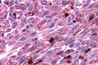 GPR81 Antibody in Immunohistochemistry (Paraffin) (IHC (P))