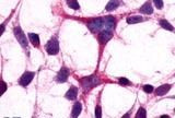 mGluR3 Antibody in Immunocytochemistry (ICC/IF)