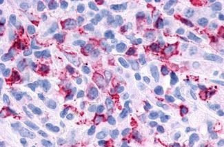 P2Y6 Antibody in Immunohistochemistry (Paraffin) (IHC (P))