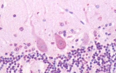 SSTR2 Antibody in Immunohistochemistry (Paraffin) (IHC (P))