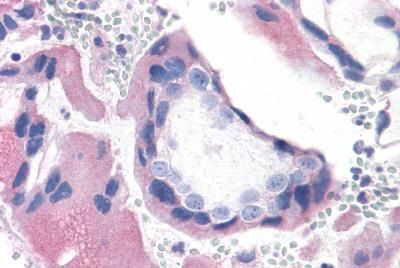 Bombesin Receptor 3 Antibody in Immunohistochemistry (Paraffin) (IHC (P))