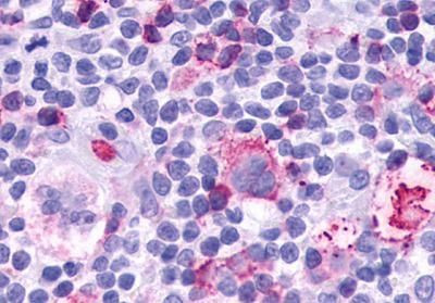 LTB4R Antibody in Immunohistochemistry (Paraffin) (IHC (P))