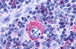 LTB4R2 Antibody in Immunohistochemistry (Paraffin) (IHC (P))