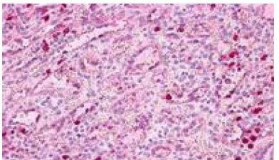 PTAFR Antibody in Immunohistochemistry (Paraffin) (IHC (P))