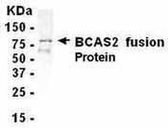 BCAS2 Antibody in Western Blot (WB)