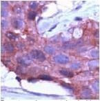 gamma Catenin Antibody in Immunohistochemistry (IHC)