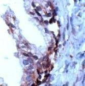 PSCA Antibody in Immunohistochemistry (Paraffin) (IHC (P))