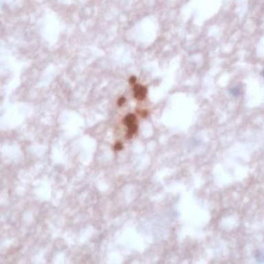 Toxoplasma gondii Antibody in Immunohistochemistry (IHC)