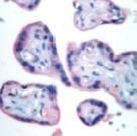 Bim Antibody in Immunohistochemistry (Paraffin) (IHC (P))