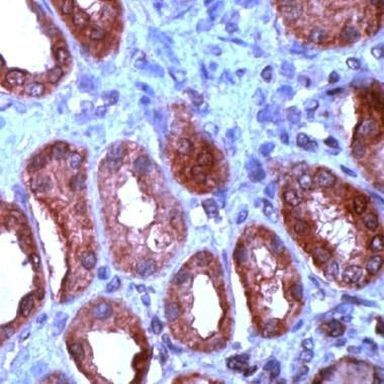 WNT1 Antibody in Immunohistochemistry (IHC)