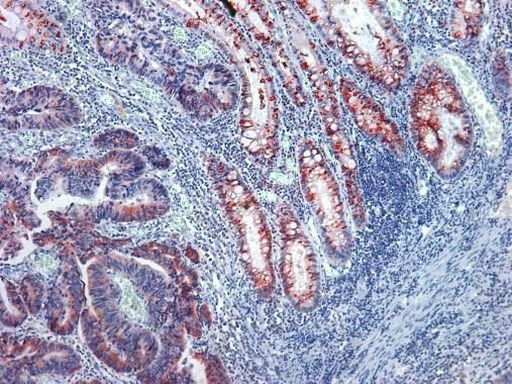Protein APC Antibody in Immunohistochemistry (IHC)