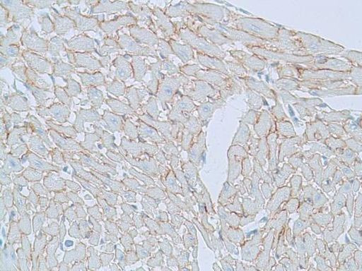 Dystrophin Antibody in Immunohistochemistry (Paraffin) (IHC (P))