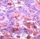 ERK1 Antibody in Immunohistochemistry (Paraffin) (IHC (P))