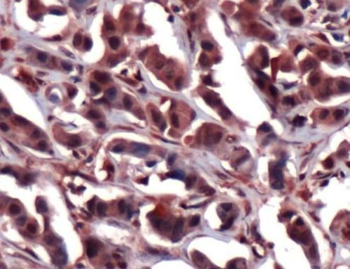 ERK2 Antibody in Immunohistochemistry (IHC)
