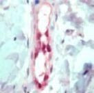 FLI1 Antibody in Immunohistochemistry (Paraffin) (IHC (P))