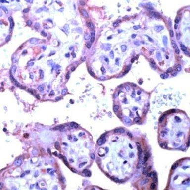 VEGF Receptor 2 Antibody in Immunohistochemistry (IHC)