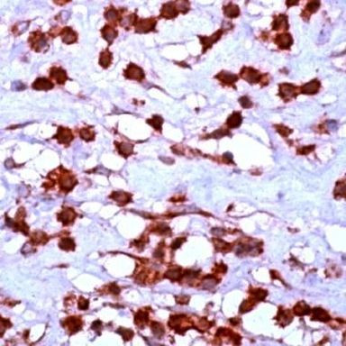 mGluR2/mGluR3 Antibody in Immunohistochemistry (IHC)
