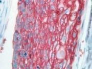 GLUT1 Antibody in Immunohistochemistry (Paraffin) (IHC (P))