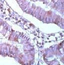 MCL1 Antibody in Immunohistochemistry (Paraffin) (IHC (P))