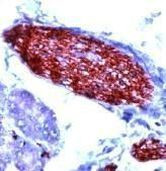 PGP9.5 Antibody in Immunohistochemistry (IHC)