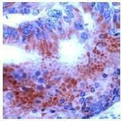 THRA Antibody in Immunohistochemistry (Paraffin) (IHC (P))