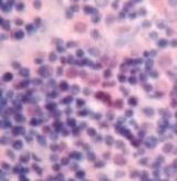 TNFR2 Antibody in Immunohistochemistry (Paraffin) (IHC (P))