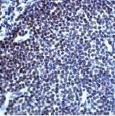 TOP2B Antibody in Immunohistochemistry (Paraffin) (IHC (P))