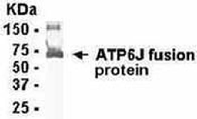 V-ATPase G1 Antibody in Western Blot (WB)