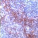 CD138 Antibody in Immunohistochemistry (Frozen) (IHC (F))