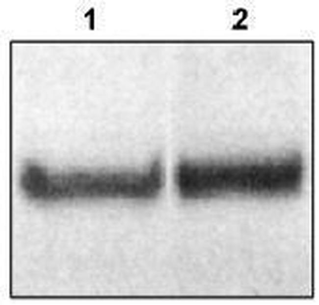 DAB1 Antibody in Western Blot (WB)