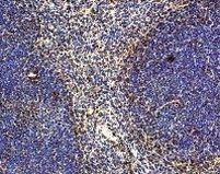 IL-22 Antibody in Immunohistochemistry (IHC)