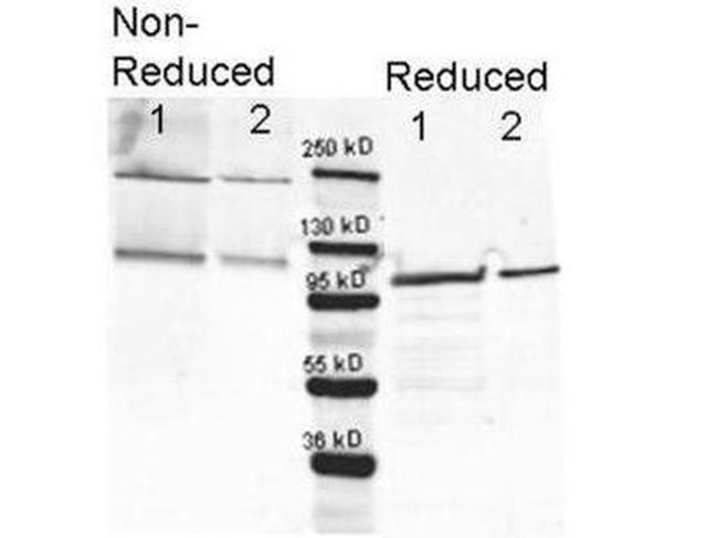 beta Galactosidase Antibody in Western Blot (WB)
