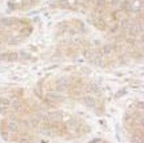 SNX1 Antibody in Immunohistochemistry (Paraffin) (IHC (P))