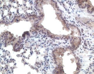 CCR11 Antibody in Immunohistochemistry (Paraffin) (IHC (P))