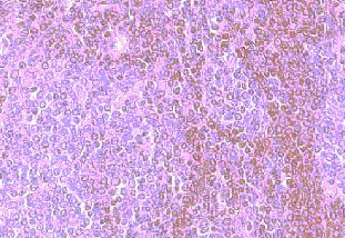 CCR8 Antibody in Immunohistochemistry (Paraffin) (IHC (P))