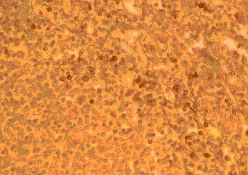 CCR2 Antibody in Immunohistochemistry (Paraffin) (IHC (P))