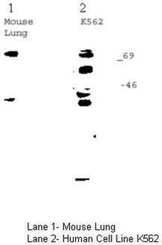 p63 Antibody in Western Blot (WB)