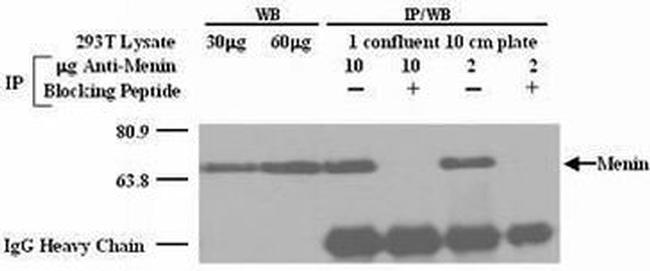 Menin Antibody in Western Blot (WB)