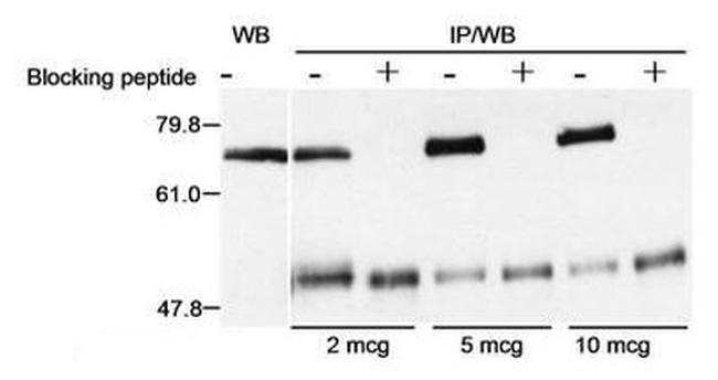 Menin Antibody in Western Blot (WB)