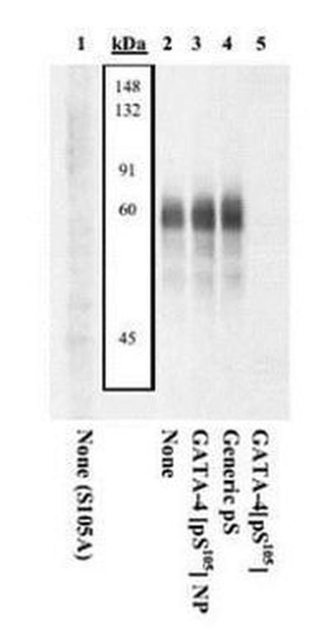 Phospho-GATA4 (Ser105) Antibody in Western Blot (WB)