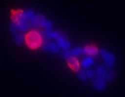 Gli1 Antibody in Immunocytochemistry (ICC/IF)