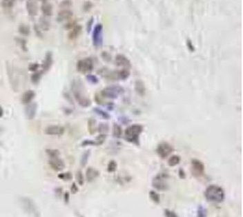 STAT6 Antibody in Immunohistochemistry (Paraffin) (IHC (P))