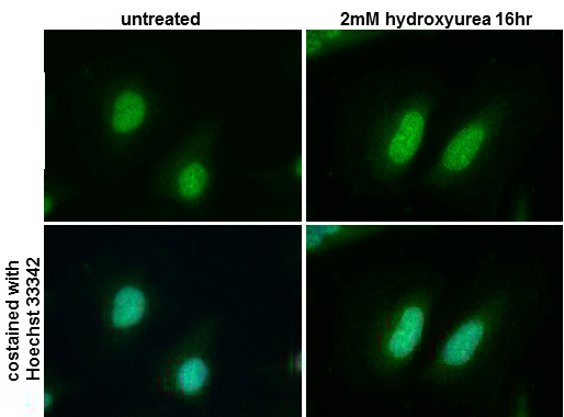 RPA2 Antibody in Immunocytochemistry (ICC/IF)