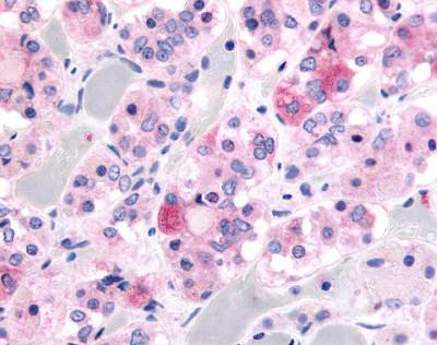 Kallikrein 9 Antibody in Immunohistochemistry (IHC)