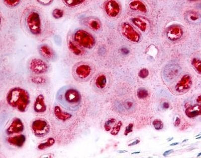 GCDFP-15 Antibody in Immunohistochemistry (IHC)