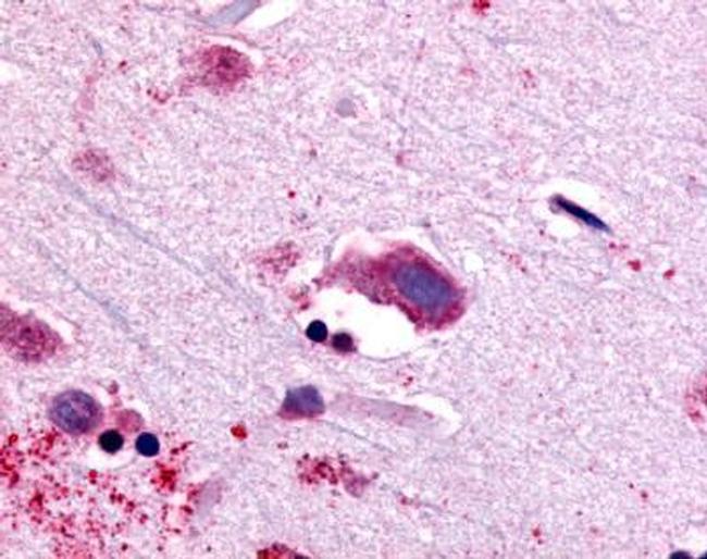 SERPINB12 Antibody in Western Blot (WB)