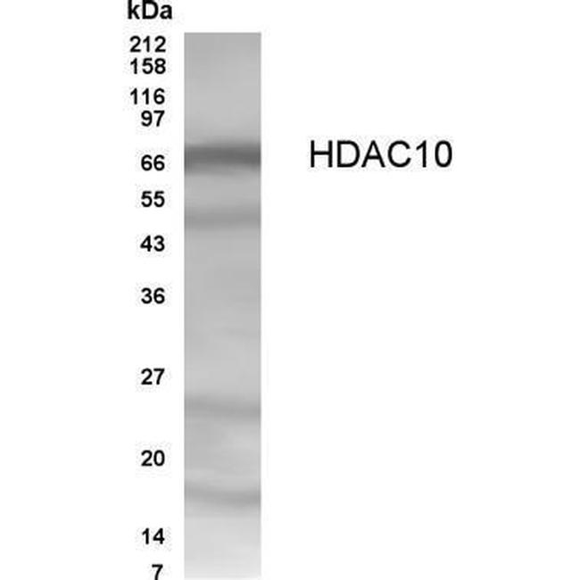 HDAC10 Antibody in Western Blot (WB)