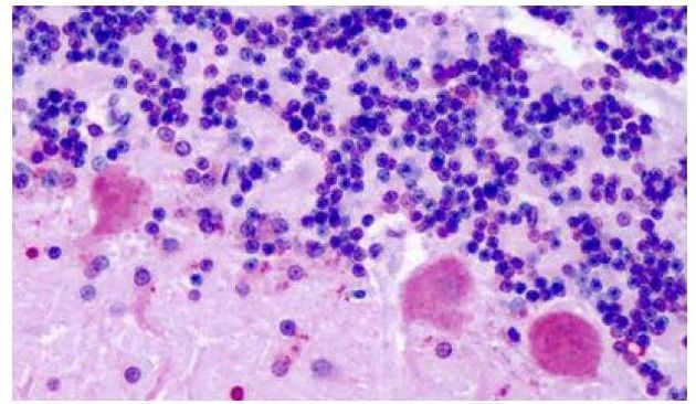 CHRM2 Antibody in Immunohistochemistry (Paraffin) (IHC (P))