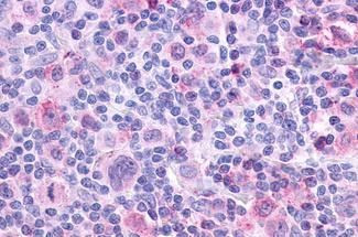 CHRM4 Antibody in Immunohistochemistry (Paraffin) (IHC (P))